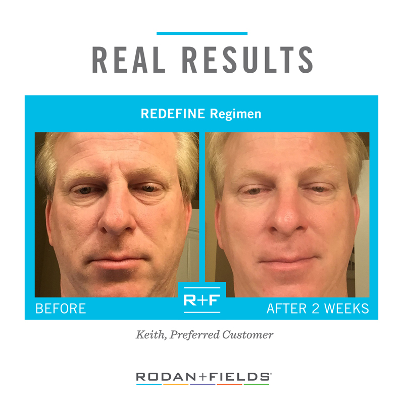 Redefine Before and After