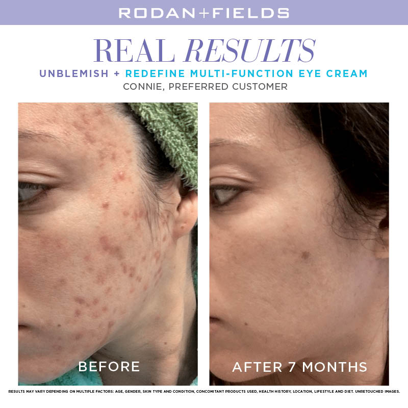 Unblemish Regimen before and after